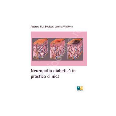 Neuropatia diabetica in practica clinica