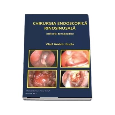 Chirurgia endoscopica rinosinusala. Indicatii terapeutice
