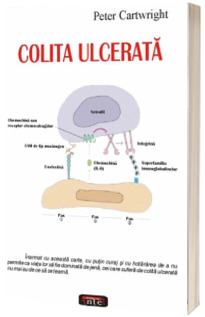 Colita ulcerata