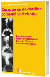 Corectarea coloanei vertebrale - Dinu Antonescu