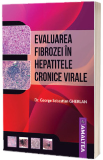 Evaluarea fibrozei in hepatitele cronice virale