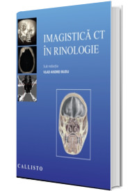 Imagistica CT in rinologie