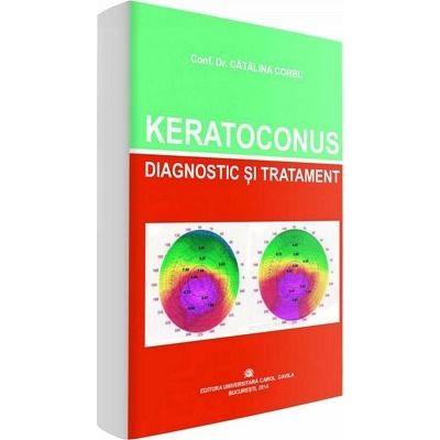 Keratoconus. Diagnostic si tratament