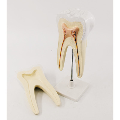 Model molar inferior cu radacina in sectiune axiala