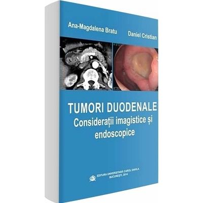 Tumori duodenale.Consideratii imagistice si endoscopice